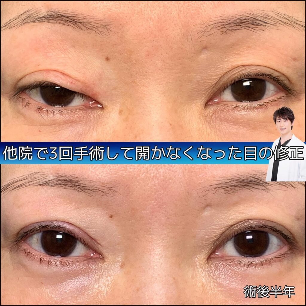 他院修正