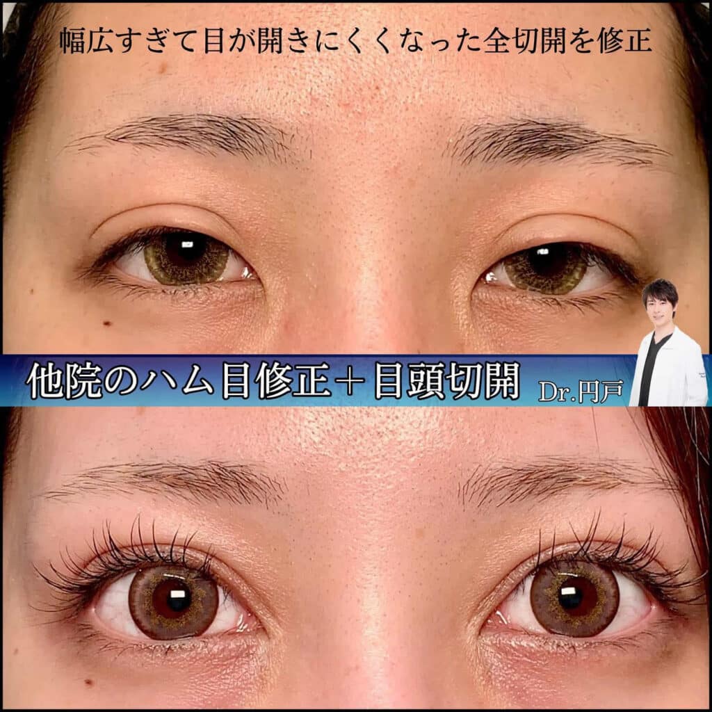 ハム目修正