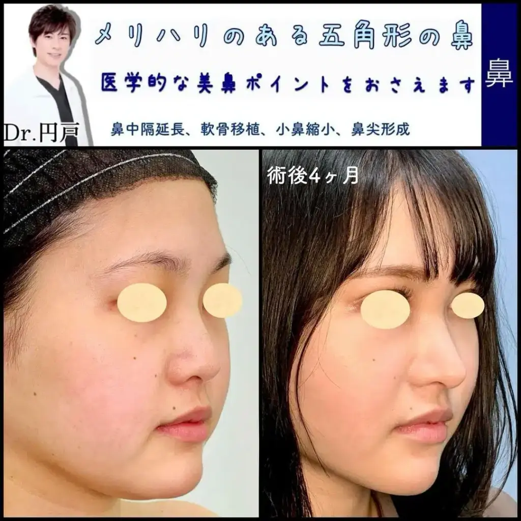 円戸医師 鼻