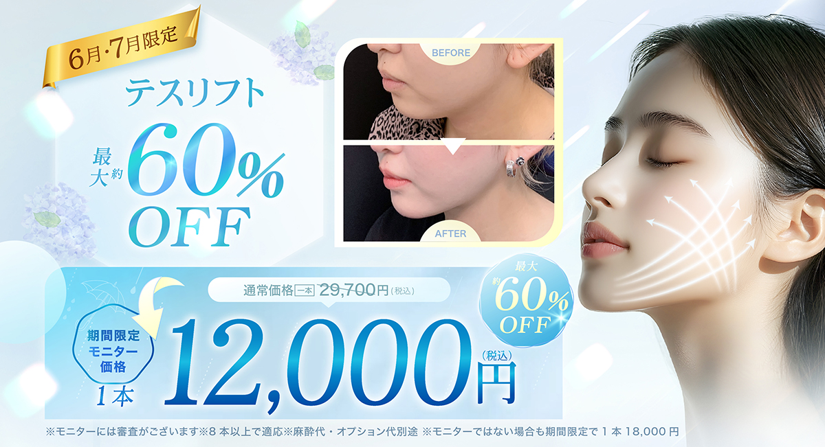 糸リフト（テスリフト）のモニターキャンペーン
