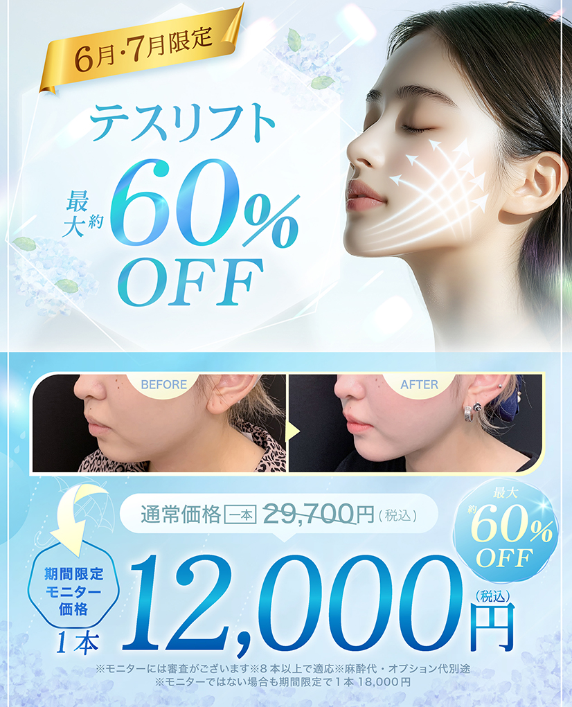 糸リフト（テスリフト）のモニターキャンペーン