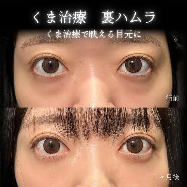 クマ取り　裏ハムラ　大阪梅田