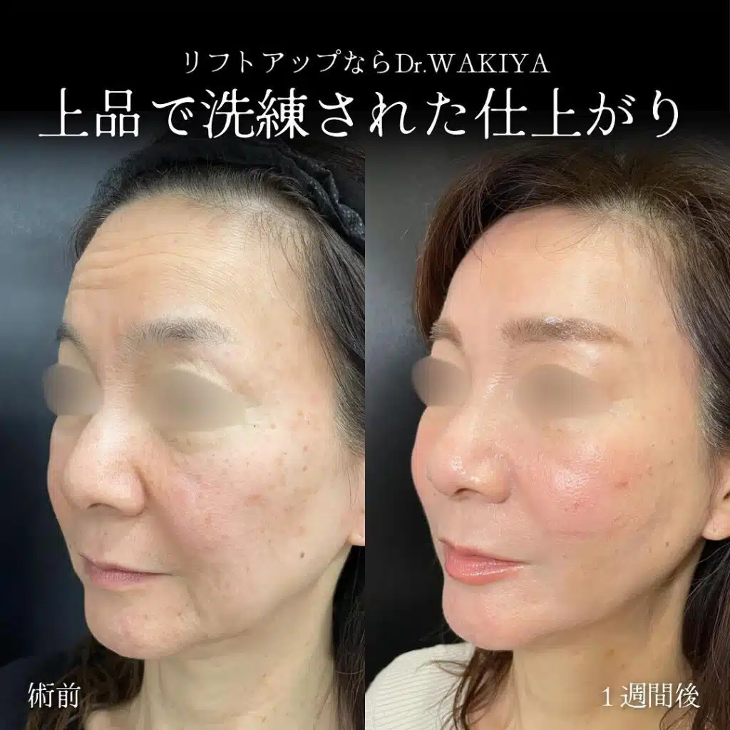 上品で洗練された仕上がり　大阪梅田