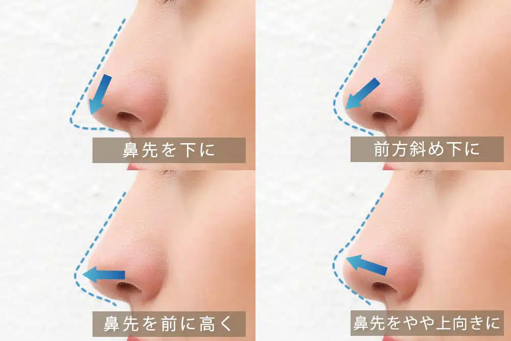 耳軟骨を鼻に挿入するデザイン　大阪梅田