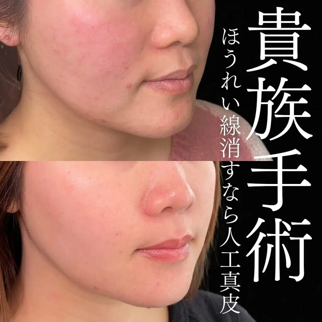 貴族手術　大阪梅田