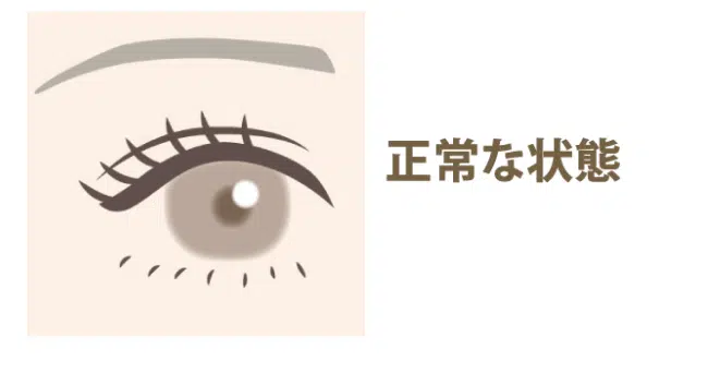 正常な目　大阪梅田