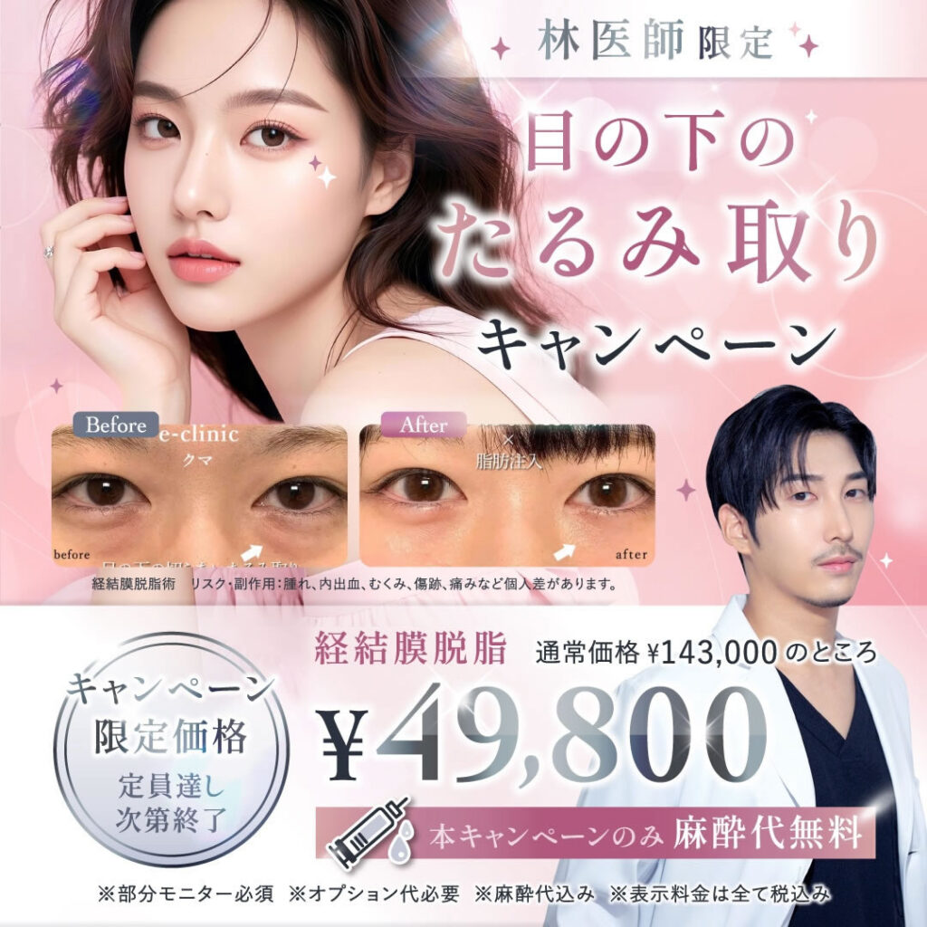 目の下のたるみ取りの梅田院のキャンペーン