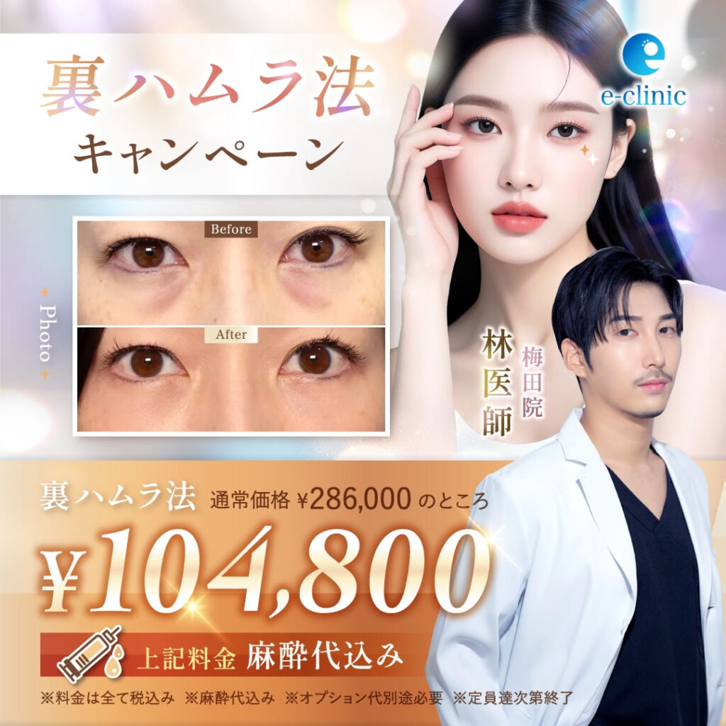 林医師裏ハムラ法キャンペーン