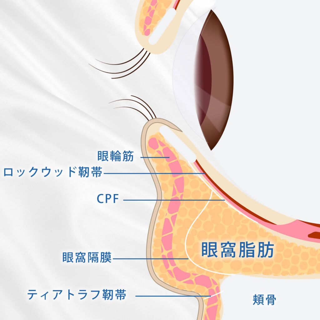 目の下のティアトラフ靭帯や眼窩隔膜や眼輪筋の図解