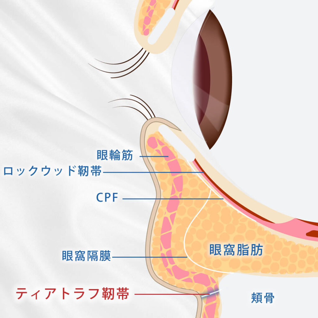 ティアトラフ靭帯の図解