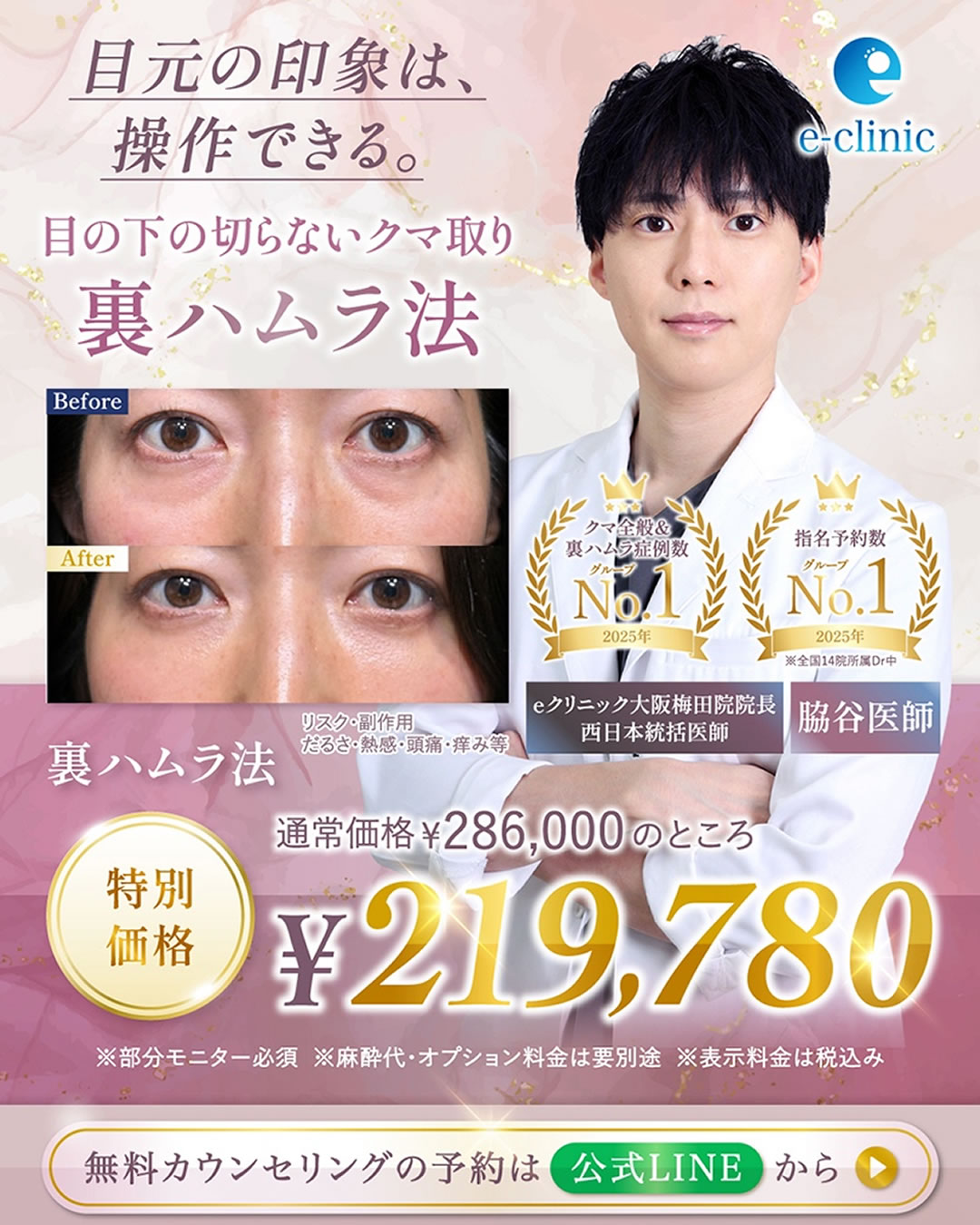 脇谷医師の裏ハムラ法のバナー 