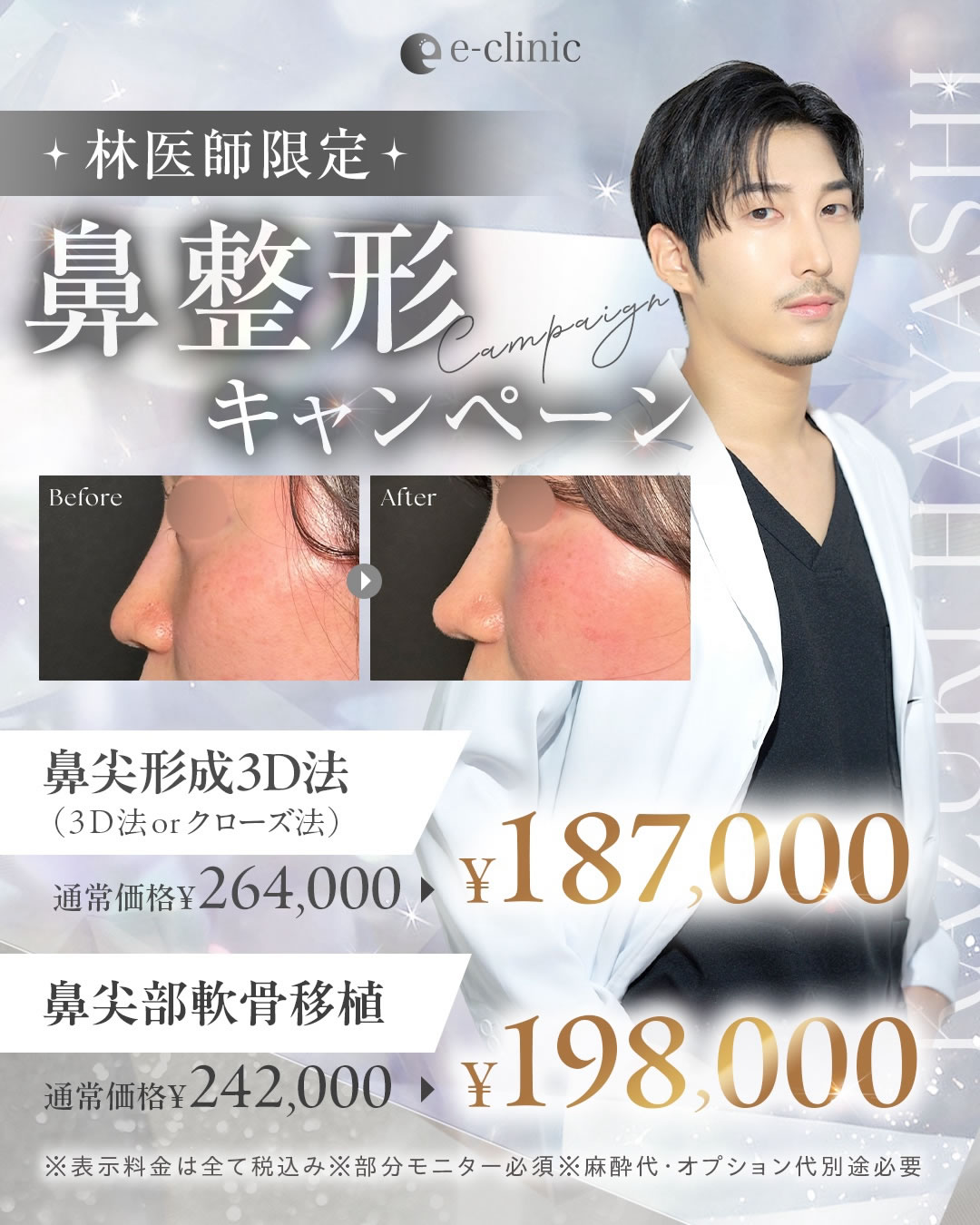 林医師の鼻整形のキャンペーン 